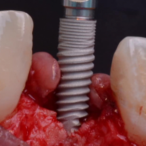 caso clínico dental